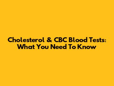 Cholesterol & CBC Blood Tests: What You Need To Know