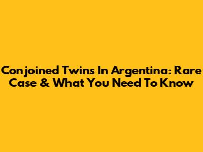 Conjoined Twins In Argentina: Rare Case & What You Need To Know