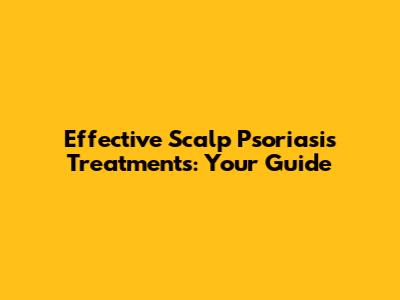 Effective Scalp Psoriasis Treatments: Your Guide