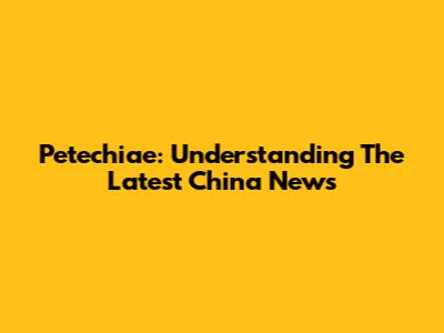 Petechiae: Understanding The Latest China News